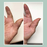 Eczema Hand Cream Bundle