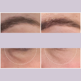 Ultralift Eye Cream for fine lines and wrinkles 15ml