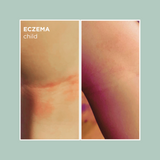 Botanical Blend 8-Hour Relief Moisturizer