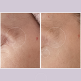 Ultralift Eye Cream for fine lines and wrinkles 15ml