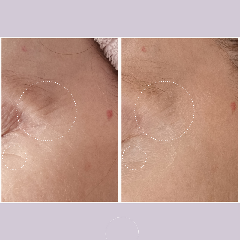 Ultralift Eye Cream for fine lines and wrinkles 15ml