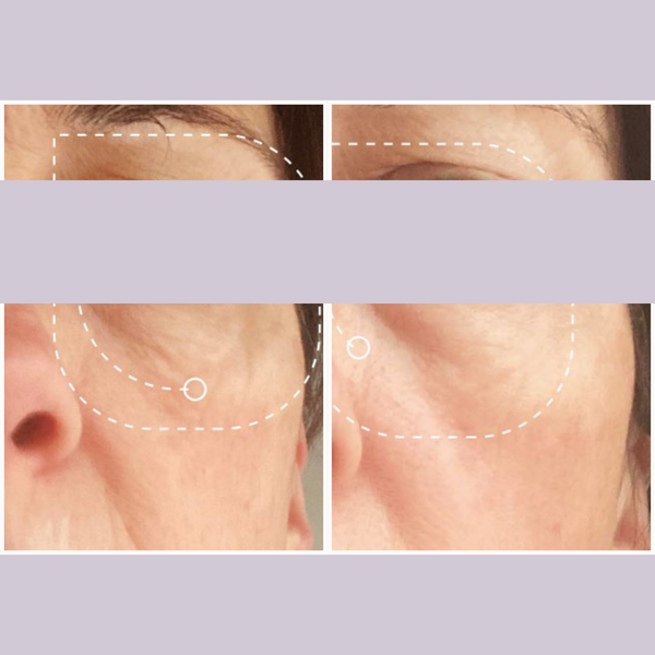 Ultralift Facial Serum for Hydration 30ml