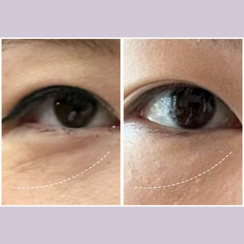 Ultralift Eye Cream for fine lines and wrinkles 15ml