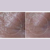 Ultralift Eye Cream for fine lines and wrinkles 15ml