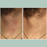 Botanical Blend 8-Hour Relief Moisturizer