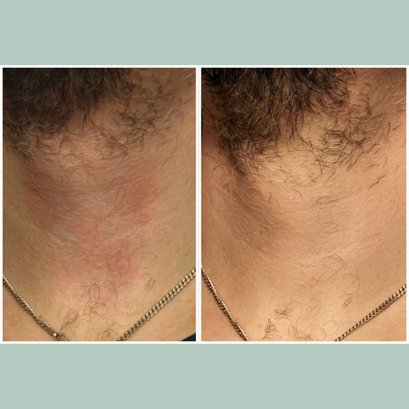 Botanical Blend 8-Hour Relief Moisturizer