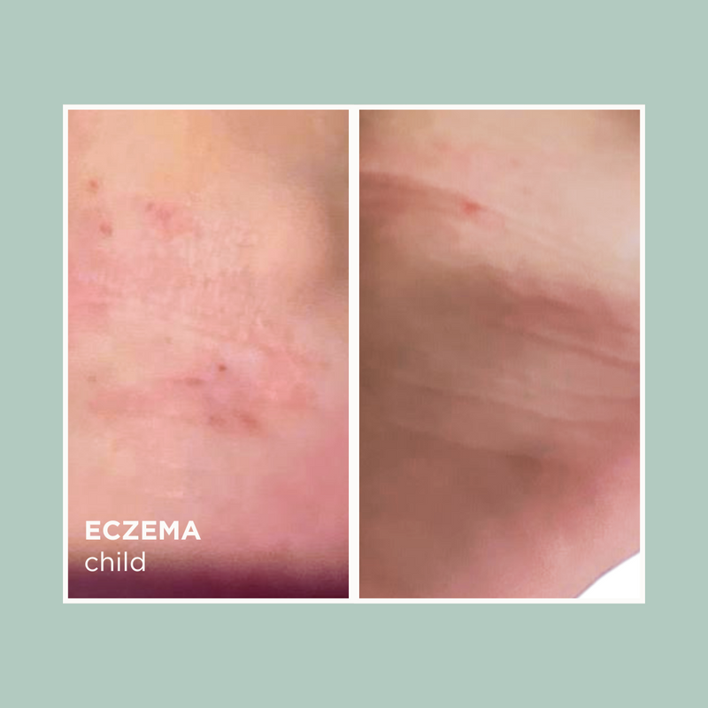 Botanical Blend Deep Replenish Serum