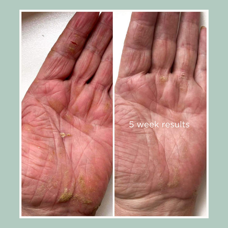 Calming Hand Cream Bundle