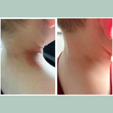 Botanical Blend 8-Hour Relief Moisturizer