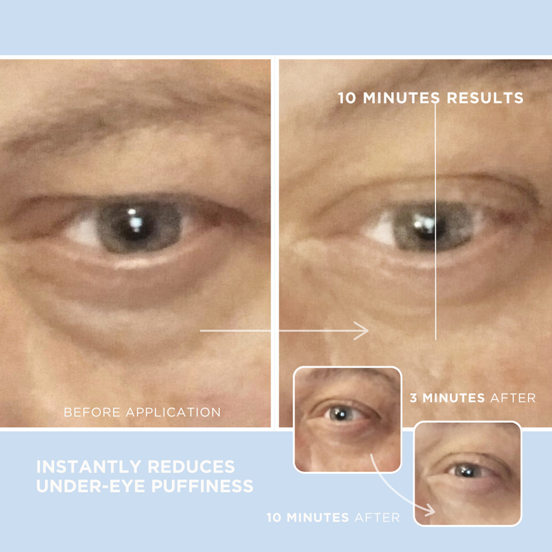 Eye Serum for Dark Circles & Puffiness