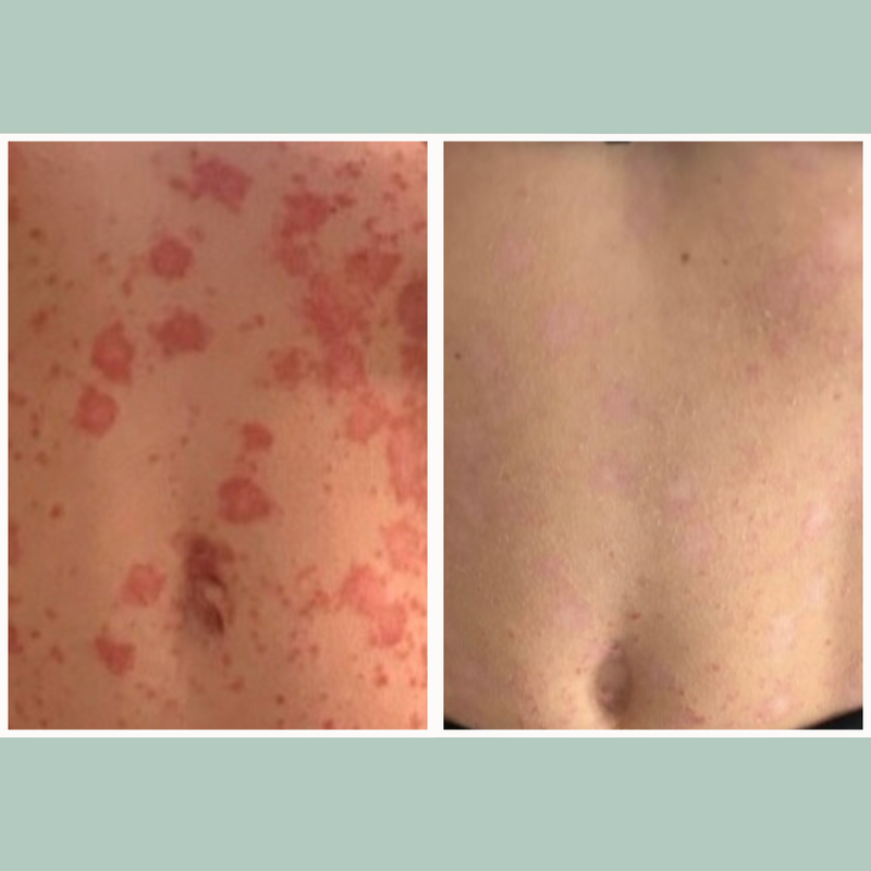 Botanical Blend 8-Hour Relief Moisturizer