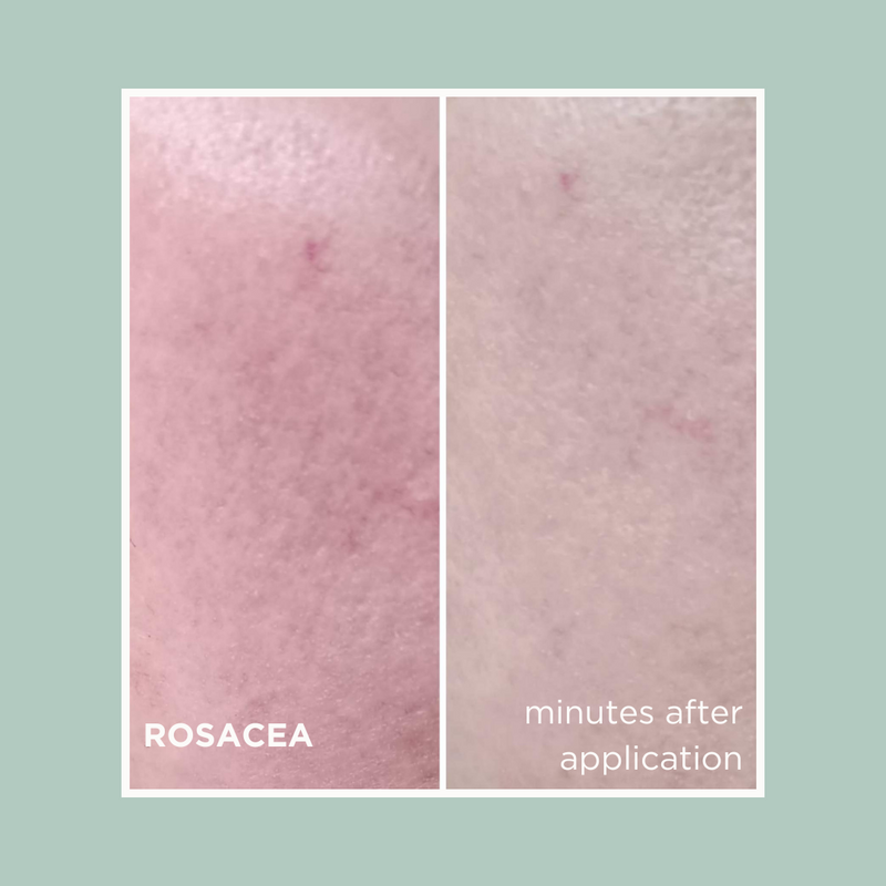Botanical Blend Deep Replenish Serum